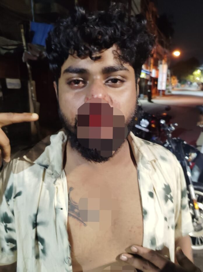 Jadavpur Incident: যাদবপুরে আক্রান্ত বিজেপি নেতা ও তাঁর বন্ধু, পুলিশের কাছে অভিযোগ দায়ের